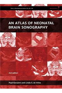 Atlas of Neonatal Brain Sonography