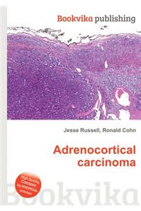 Adrenocortical Carcinoma
