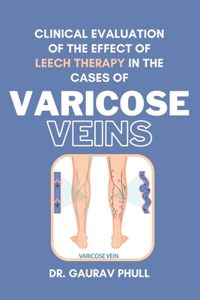 Clinical Evaluation of the Effect of Leech Therapy in the Cases of Varicose Veins