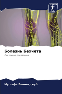 Болезнь Бехчета