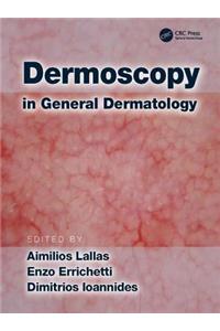 Dermoscopy in General Dermatology