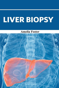 Liver Biopsy