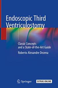 Endoscopic Third Ventriculostomy