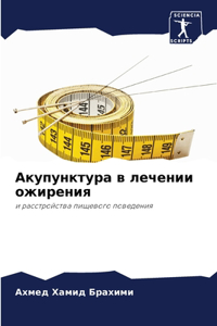 Акупунктура в лечении ожирения