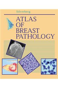 Atlas of Breast Pathology (Atlases in  Diagnostic Surgical Pathology)