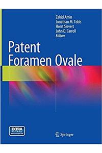 Patent Foramen Ovale