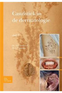 Casuïstiek in de Dermatologie - Deel 2