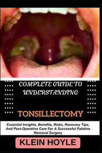 Complete Guide to Understanding Tonsillectomy
