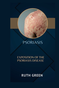 Psoriasis