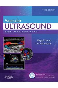 Vascular Ultrasound