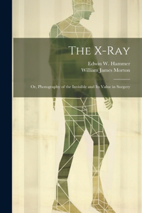 X-Ray; Or, Photography of the Invisible and Its Value in Surgery