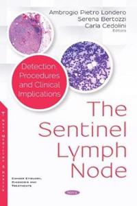 The Sentinel Lymph Node