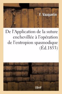 de l'Application de la Suture Enchevillée À l'Opération de l'Entropion Spasmodique