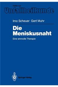Die Meniskusnaht