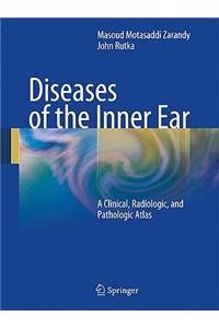 Diseases of the Inner Ear