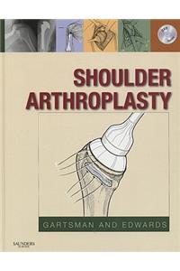 Shoulder Arthroplasty