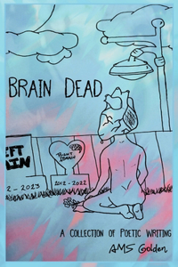 Brain Dead