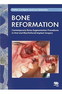 Bone Reformation