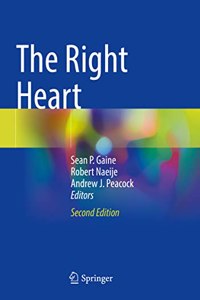 Right Heart