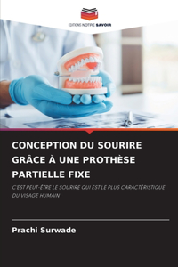 Conception Du Sourire Grâce À Une Prothèse Partielle Fixe