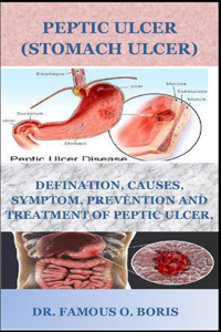 Peptic Ulcer (Stomach Ulcers)