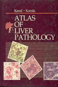Atlas of Liver Pathology (Atlases in Diagnostic Surgical Pathology)