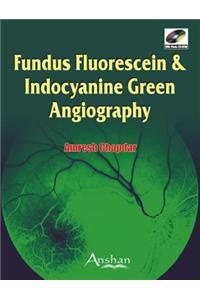 Fundus Fluorescein and Indocyanine Green Angiography