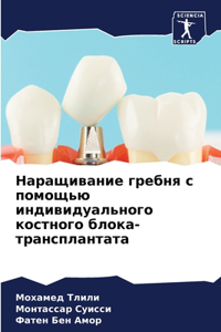 Наращивание гребня с помощью индивидуаль