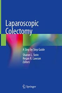 Laparoscopic Colectomy