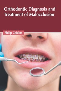 Orthodontic Diagnosis and Treatment of Malocclusion