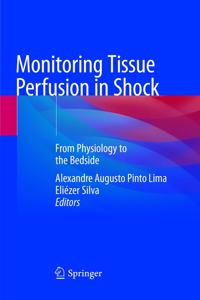 Monitoring Tissue Perfusion in Shock