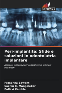Peri-implantite: Sfide e soluzioni in odontoiatria implantare