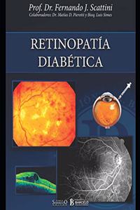 Retinopatía diabética