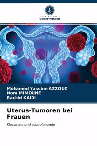 Uterus-Tumoren bei Frauen