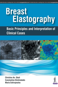 Breast Elastography