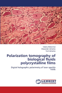 Polarization tomography of biological fluids polycrystalline films