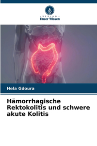 Hämorrhagische Rektokolitis und schwere akute Kolitis