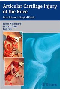 Articular Cartilage Injury of the Knee