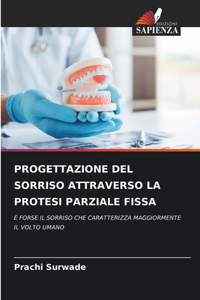 Progettazione del Sorriso Attraverso La Protesi Parziale Fissa