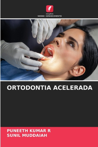 Ortodontia Acelerada