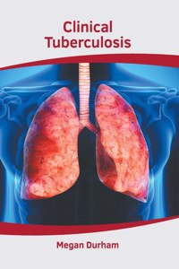 Clinical Tuberculosis