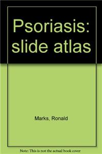 Psoriasis: slide atlas