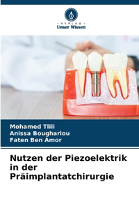 Nutzen der Piezoelektrik in der Präimplantatchirurgie