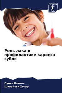 Роль лака в профилактике кариеса зубов