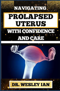 Navigating Prolapsed Uterus with Confidence and Care