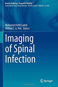 Imaging of Spinal Infection