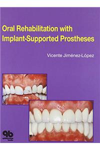 Oral Rehabilitation With Implant-Supported Prostheses