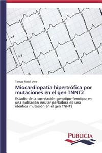 Miocardiopatía hipertrófica por mutaciones en el gen TNNT2