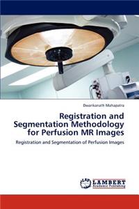 Registration and Segmentation Methodology for Perfusion MR Images