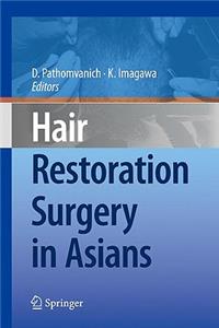 Hair Restoration Surgery in Asians